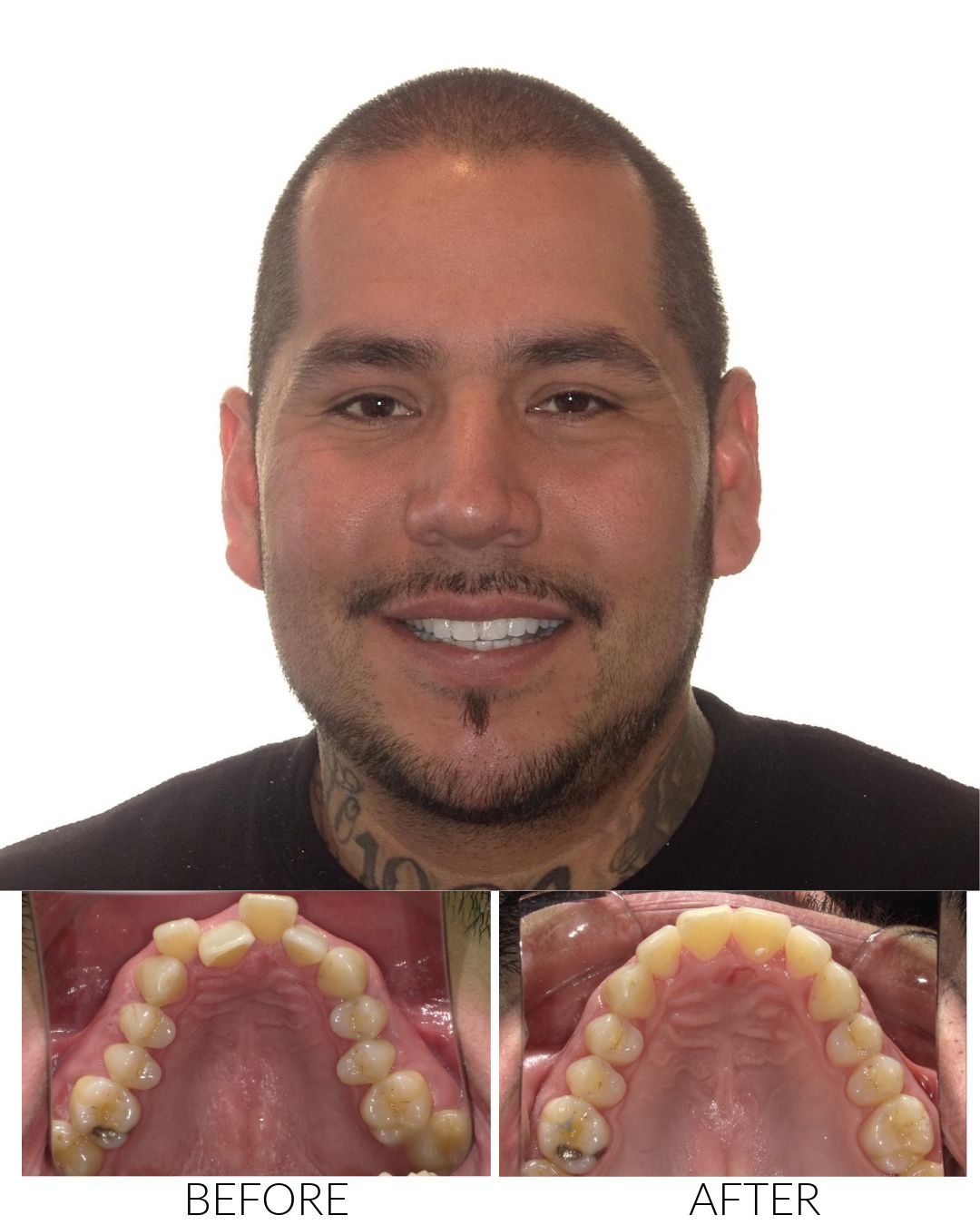 Hello Ortho Smile Model Petaluma Copy Hello Ortho