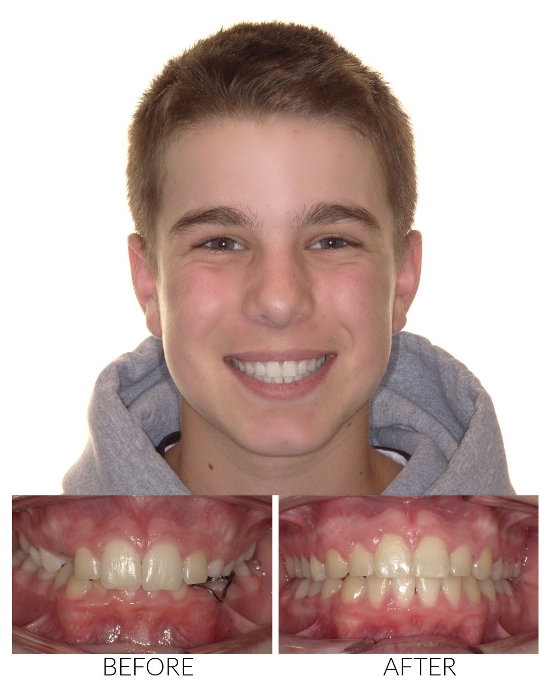 Hello Ortho Smile Model Petaluma Copy Hello Ortho