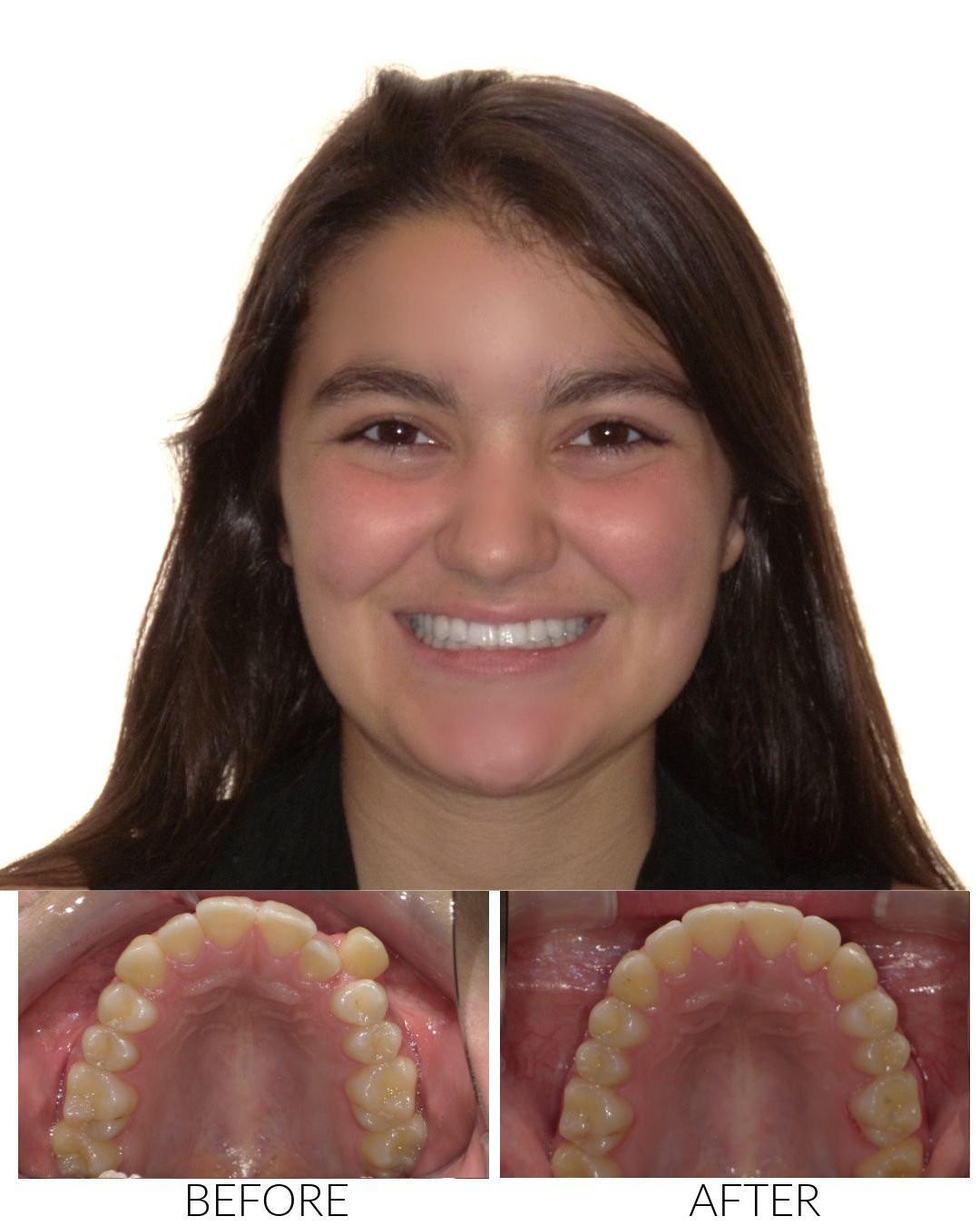 NapaPetalumaSmiles Hello Ortho